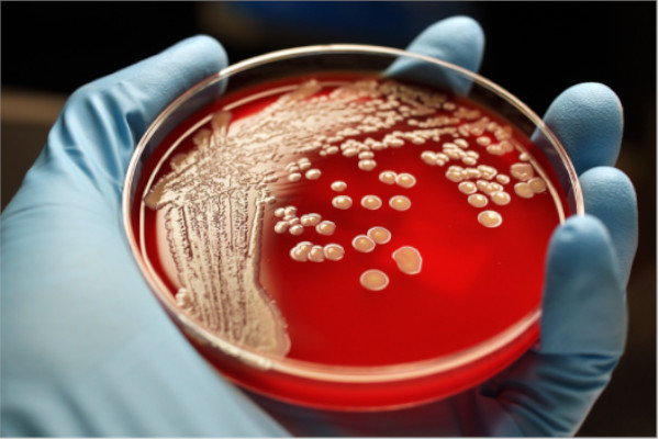 Microbiological Petri Dish